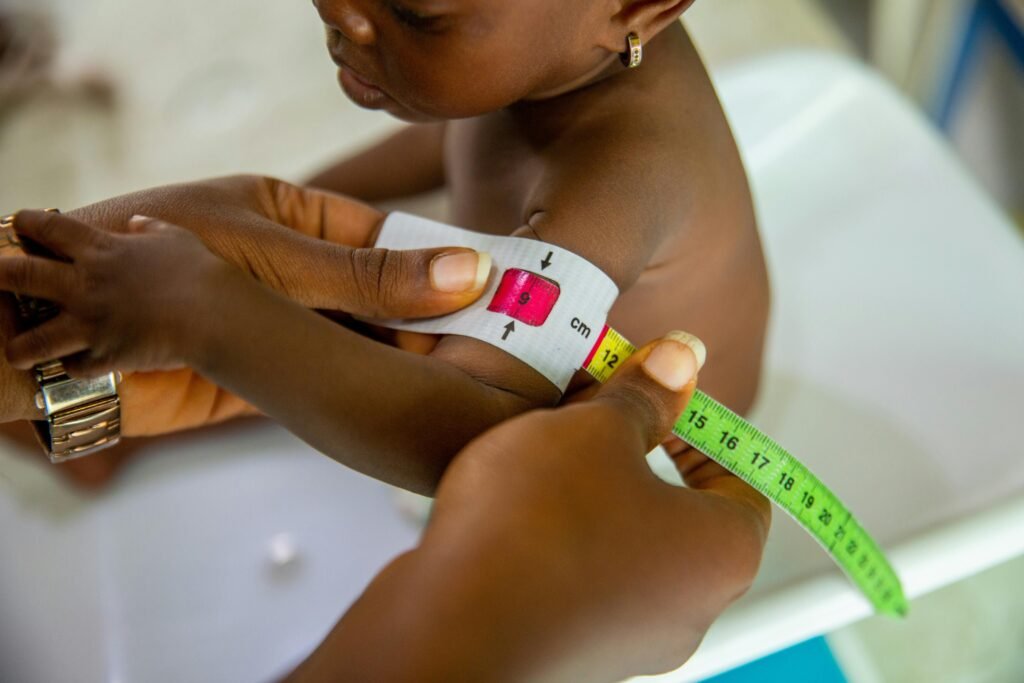 A healthcare professional measures a child's arm using MUAC tape for malnutrition assessment.
